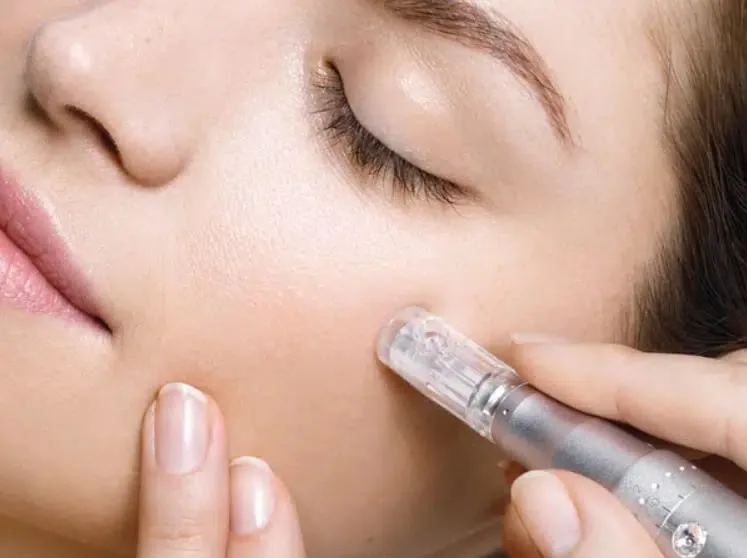 Acne scar treatment PRP