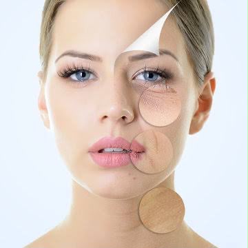 Medical grade chemical peel