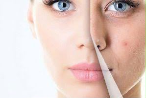 Polynucleotides under-eye treatment at Clinic 8, West Malling