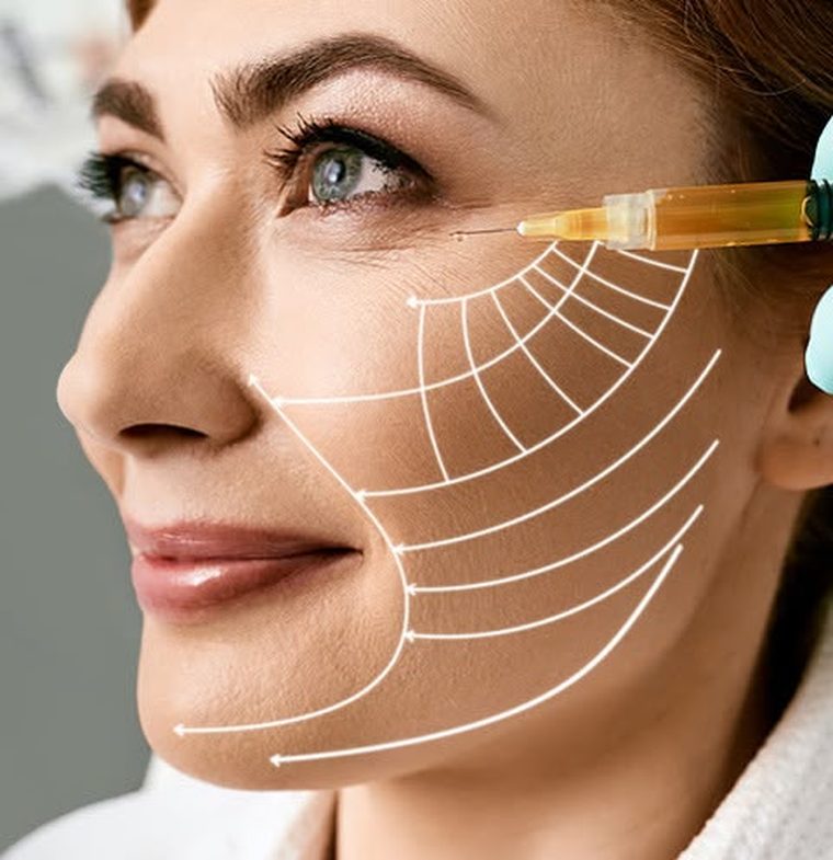PRP / Vampire facial treatment at Clinic 8, West Malling