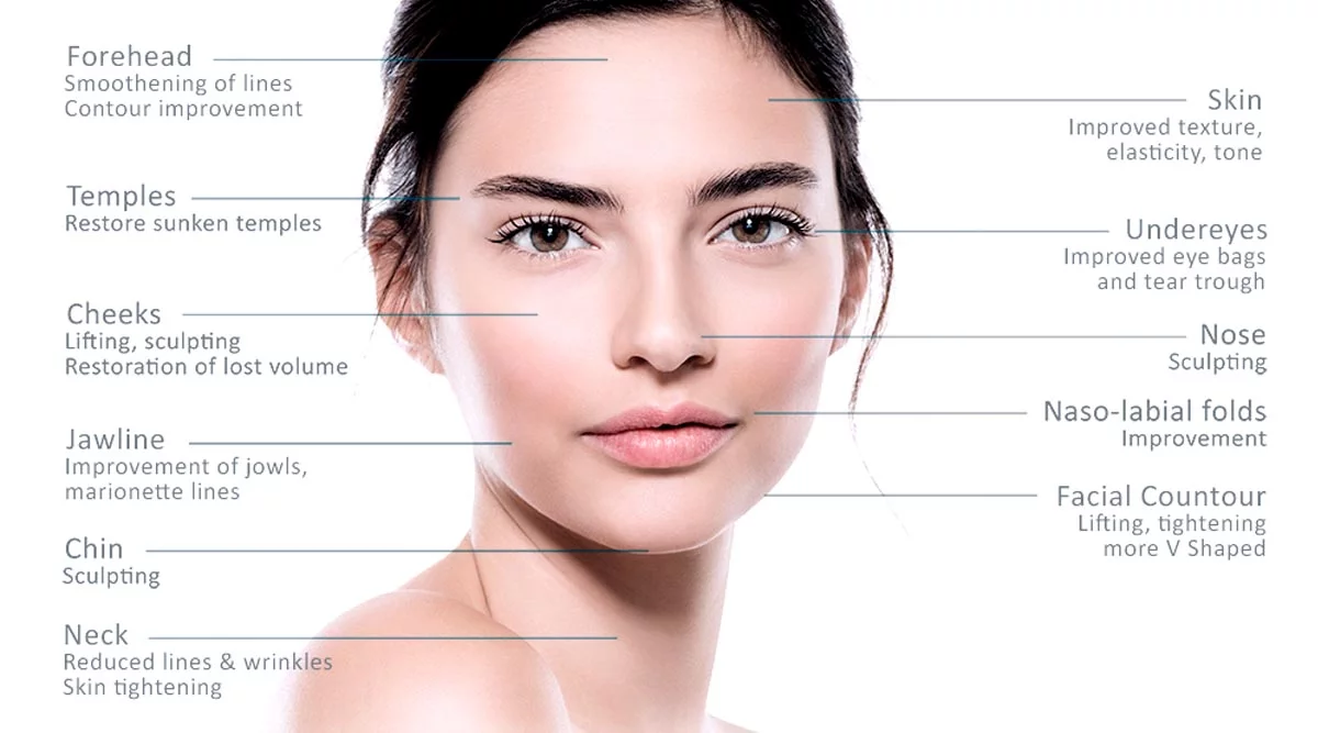 Radiesse CaHA biostimulator treatment areas